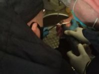 У Києві чоловік ледь не втратив палець через каблучку