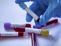 У Києві найбільше нових випадків COVID-19 виявили у Деснянському районі