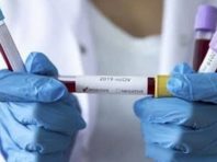 У Києві кількість хворих на коронавірус збільшилася на 77 людей