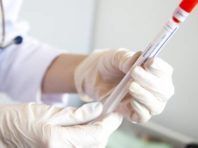 У Києві зафіксували спалах коронавірусу в одному з гуртожитків КПІ