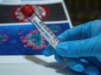 Гравець українського футбольного клубу заразився коронавірусом