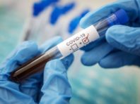Негативні ковід-тести української збірної можуть серйозно вплинути на рішення УЄФА – швейцарські ЗМІ