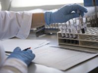 Чи варто робити тест на антитіла після COVID-вакцинації або одужання: відповідь МОЗ