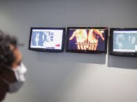 В Україні зареєстрували другий випадок віспи мавп